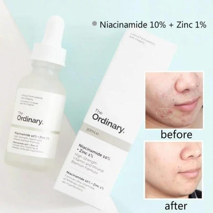 Skin Brightening Niacinamide Serum